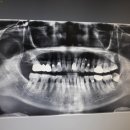 열린미소치과의원 이미지