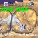 윤치과기공소 이미지