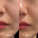 고미다미 | 수유역피부관리, 처진 얼굴살 고민으로 방문한 큐티도도 아카데미 하이푸리프팅 후기