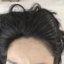 클린 앤 디테일 | 서면 문제성피부 관리, 빼어날수 페이스앤바디 좁쌀여드름 압출 후기