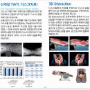 인천목디스크 확실히 효과있네요