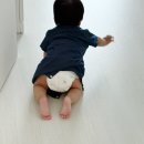 신생아 딤플 원인 초음파 검사후기