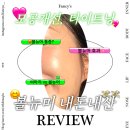 보이는 당구 (100이상)A | 내돈내산 30대 볼뉴머 리프팅 후기 📍신논현역피부과 볼뉴머 잘하는 곳, 통증, 효과, 붓기 B/A