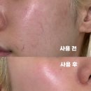 피부에봄이오다 | 속건조가 심한 민감피부라면?" 아벤느 이드랑스 리치 보습크림 추천, 찐 건성피부 사용 후기 (+성분, 가격)