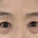 스칼프랩앤뷰티 네이버블로그