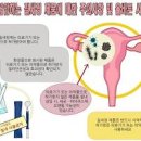 질건강 생활수칙과 여성 질 유산균 정보리스펙타 이미지