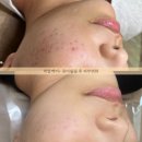 봄 에스테틱 네이버블로그