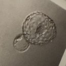 우리동네 카 센터 | 임신준비 11 | 동결5일배아 이식, 1~2차 피검사 결과(그리고 임테기를 곁들인)