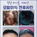 청담코지의원 네이버블로그