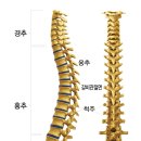 척추교정이란? 이미지