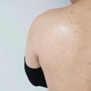 울트라케어 | 모낭염 주사피부염 얼굴붉은기 고민 해결템? 지루샵 세라케어 울트라스킨 리얼후기