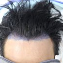 압구정맘모스헤어라인의원 이미지