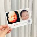 고은빛실사랑 | 입체초음파 시기와 실물 미리보기 gpt와 ai