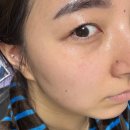 바른약국 | 약국화장품 추천 시술후재생크림으로 유명한 어드밴스드 PDRN 리쥬비네이팅 크림 사용 후기