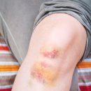 지킴메디 이미지