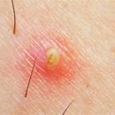 동그라미센터 이미지