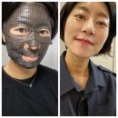 &#34;유니앤코어&#34; 7일사용후기.1일1팩후기.파리낙상피부.비타민앰플 미백100%효과.딱3일만써보세요.