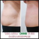 덕진-97 | 전주만성동피부관리, 다이어트 실패한 사람 97%가 몰랐던 ‘이것’