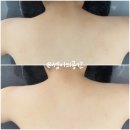 미사바이오포톤 | 미사 다이어트 리타임뷰티 승모근 온열돔 관리 후기