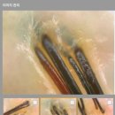 감탄헤드스파 두피클리닉