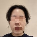 시청역(1) 화장실 | 서울 시청역 피부과 방문기｜명동 30대 여자 티타늄 리프팅 추천 변화 후기