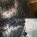 지에스25 광주클리닉 | 진월동미용실 헤리티살롱 잔머리펌 &amp; 두피클리닉 후기
