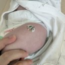 엠블병원 | 대전 베이포투스 가격 접종 시기 신생아 RSV 엠블병원 후기