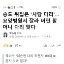 송도 뒤집은 '사람 다리'…요양병원서 잘라 버린 할머니 다리 맞다 이미지