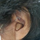 시그니아독일보청기대구북구센터 이미지