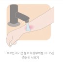 푸른소독 | 제주 화상 병원: 제주푸른병원 치료 후기 및 화상 응급처치 꿀팁 (제주살이 중 비상사태!) 🏥