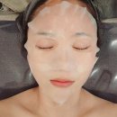 바이스앤 대구(주) | 대구 동구 피부관리 윤스킨앤바디 블랙 프리미엄 브라이트닝 써모젯 스페셜 피부관리 후기