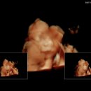 리멤버8 | 임신일기 08 : 18주 ~ 22주 (경기도 임산부 교통비 지원사업, 트립트랩 구매, 22주 입체초음파, 신라...
