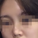 포시즌성형외과