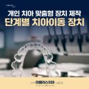 미플러스치과기공소 이미지