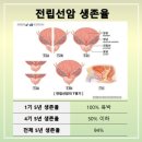 전립선암 조기발견 PSA 검사 이미지