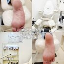 울산 발각질 관리 레푸스 울산삼산점 후기