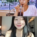 권장덕케이성형외과의원 | 29살인데 37살 소리 듣다가 강남 성형외과 눈밑지방재배치 결심한 사람 1년 후기