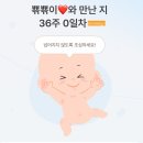 웅선생 | #임신후기 : 임신 35주+6일 “비골 골절+인대 파열 수술” - 부산 좋은문화병원