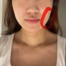 압구정라인성형외과의원 이미지