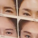 비씨아이성형외과의원 이미지