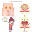 피지오스