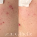 솜 에스테틱 이미지