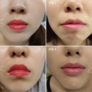 오버더지니