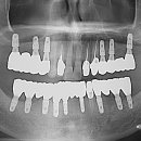 바른길치과의원 이미지