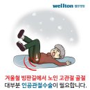 고관절 골절 후 적절한 조치를 취하지 않으면 사망률이 90%에 이를 수 있습니다. 고관절골절 이미지