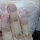 씻고;바르는천연배움터 | 볼 여드름 원인 찾다 만난 4단계 루틴, 붉은기까지 진정된 후기