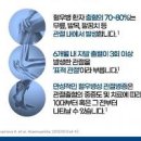 피가 멈추지 않는 병 혈우병 원인 증상 치료 이미지