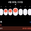 남일한의원 | 인공수정 준비완료, 1차 시술