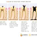 서울테라치과 이미지
