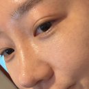 유딘바이오 이미지